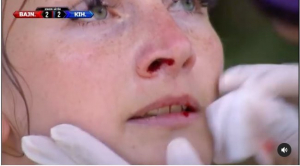 Ömlött a vér az Exatlon Hungary forgatásán, Zsófi csak nyögni és lihegni tudott a fájdalomtól - Videó