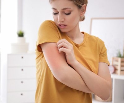 Mit ne egyél, ha allergiás vagy? Ezek az ételek felerősíthetik a tüneteket